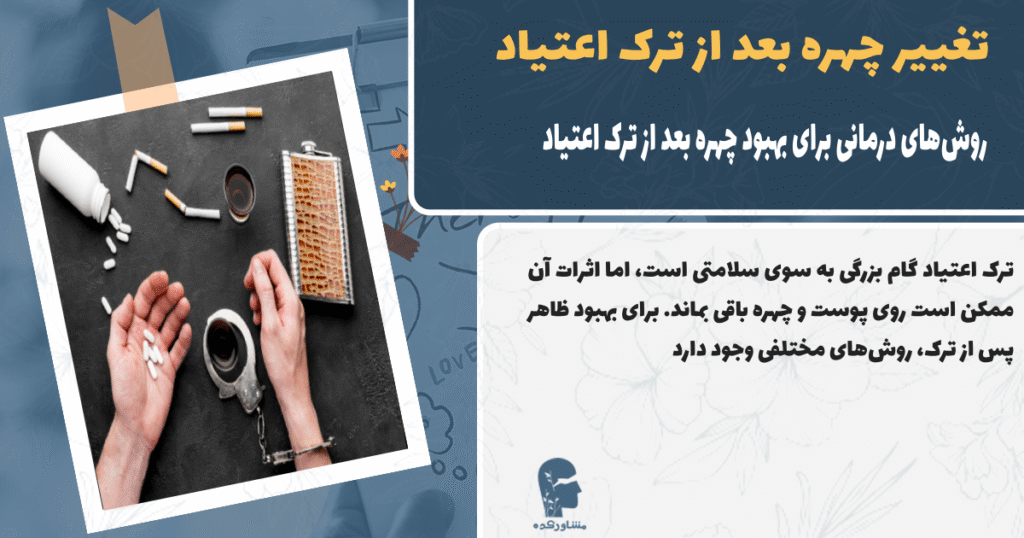 روش های درمانی برای بهبود چهره بعد از ترک اعتیاد